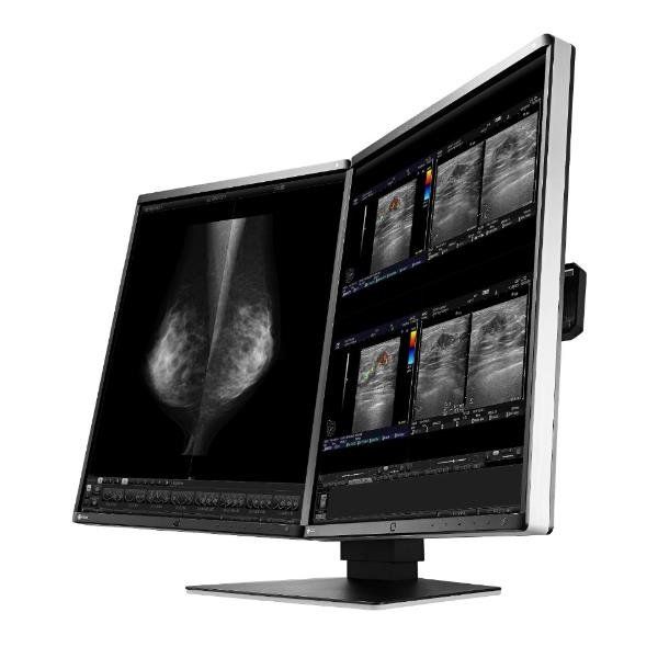 Eizo RadiForce RX560-MD